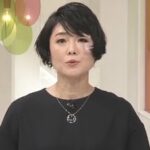【画像】有働由美子アナ、news zeroの降板発表の当日になぜか顔面に怪我をしてしまう